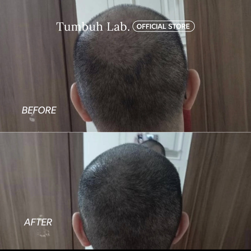 Tumbuh Lab Hair Oil Original Chinese New Year Edition